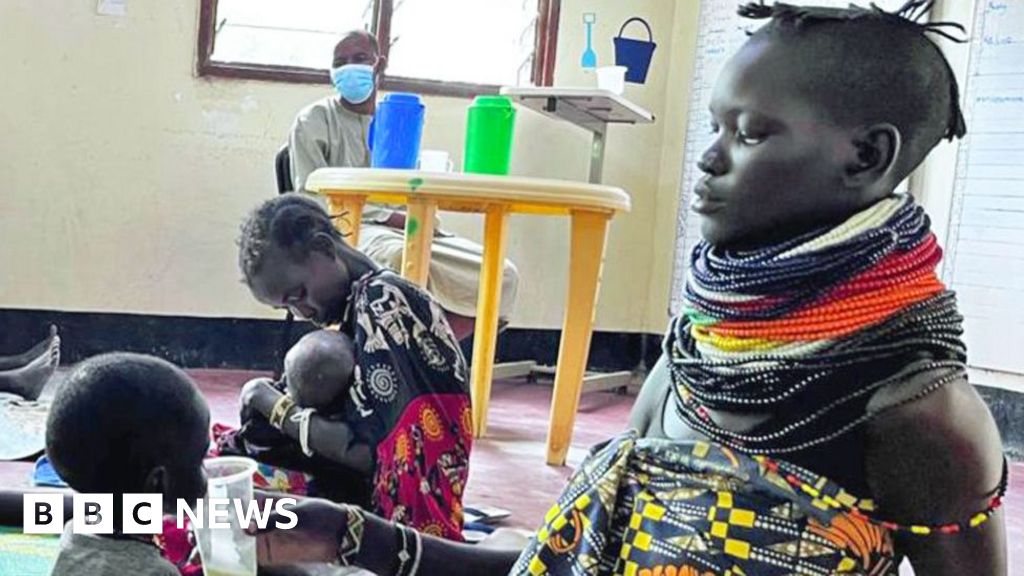 Malnutrition in Kenya's Kakuma refugee camp after US aid cuts